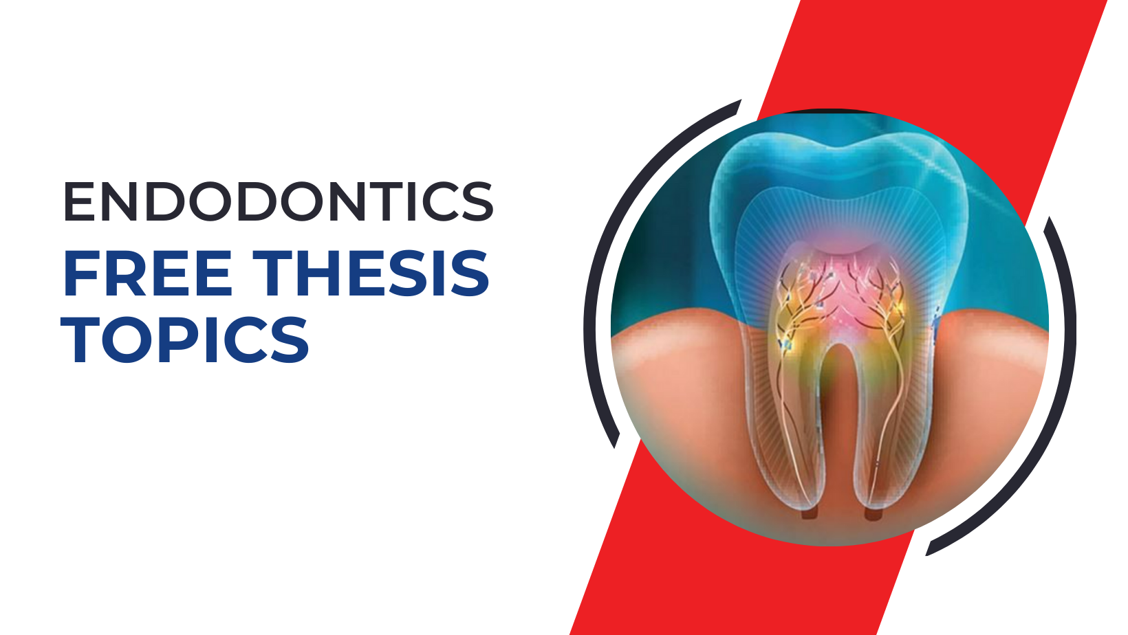 thesis topics in endodontics