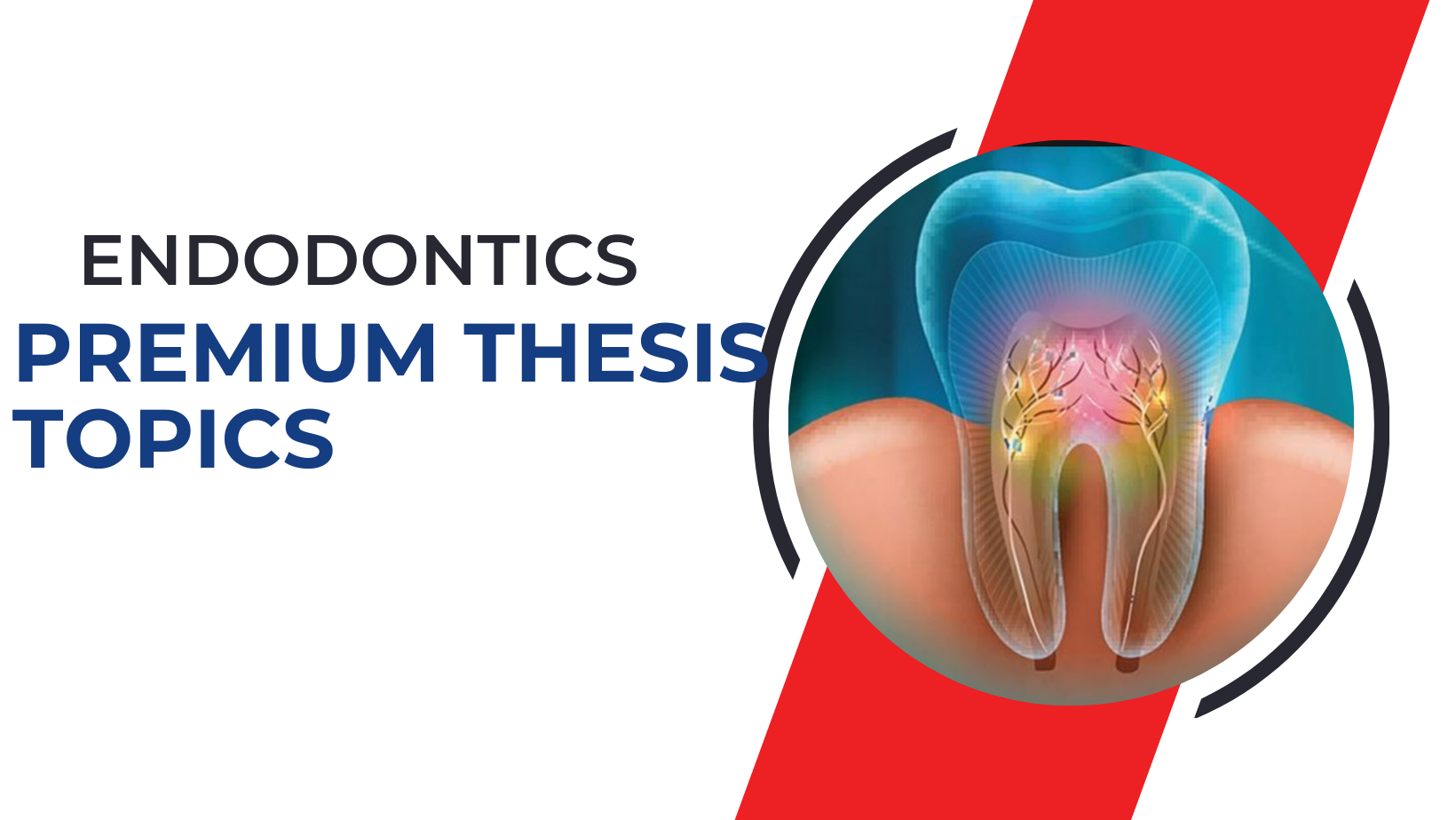 Endodontics premium Thesis Topics