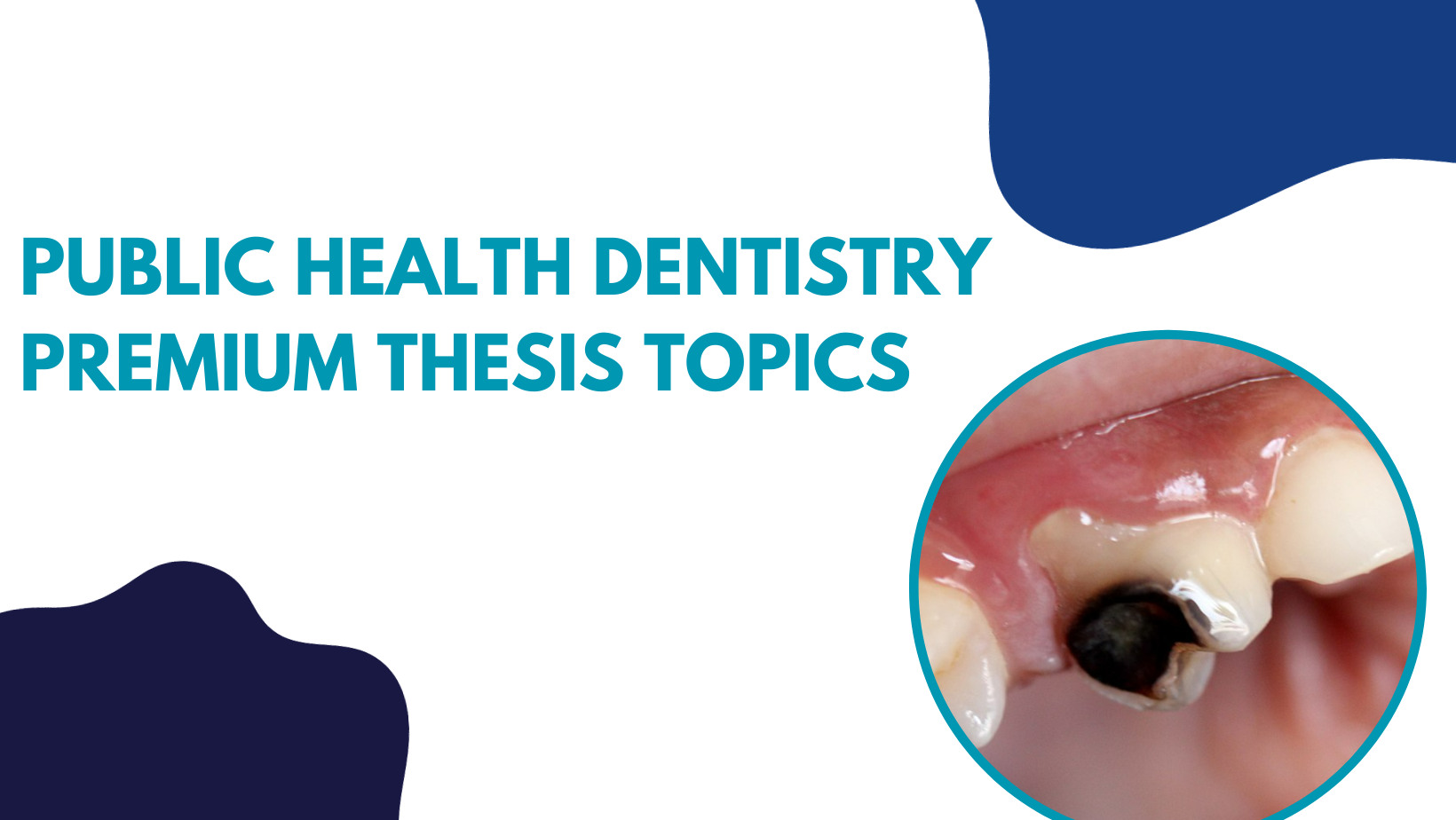 Public health dentistry Premium thesis topics