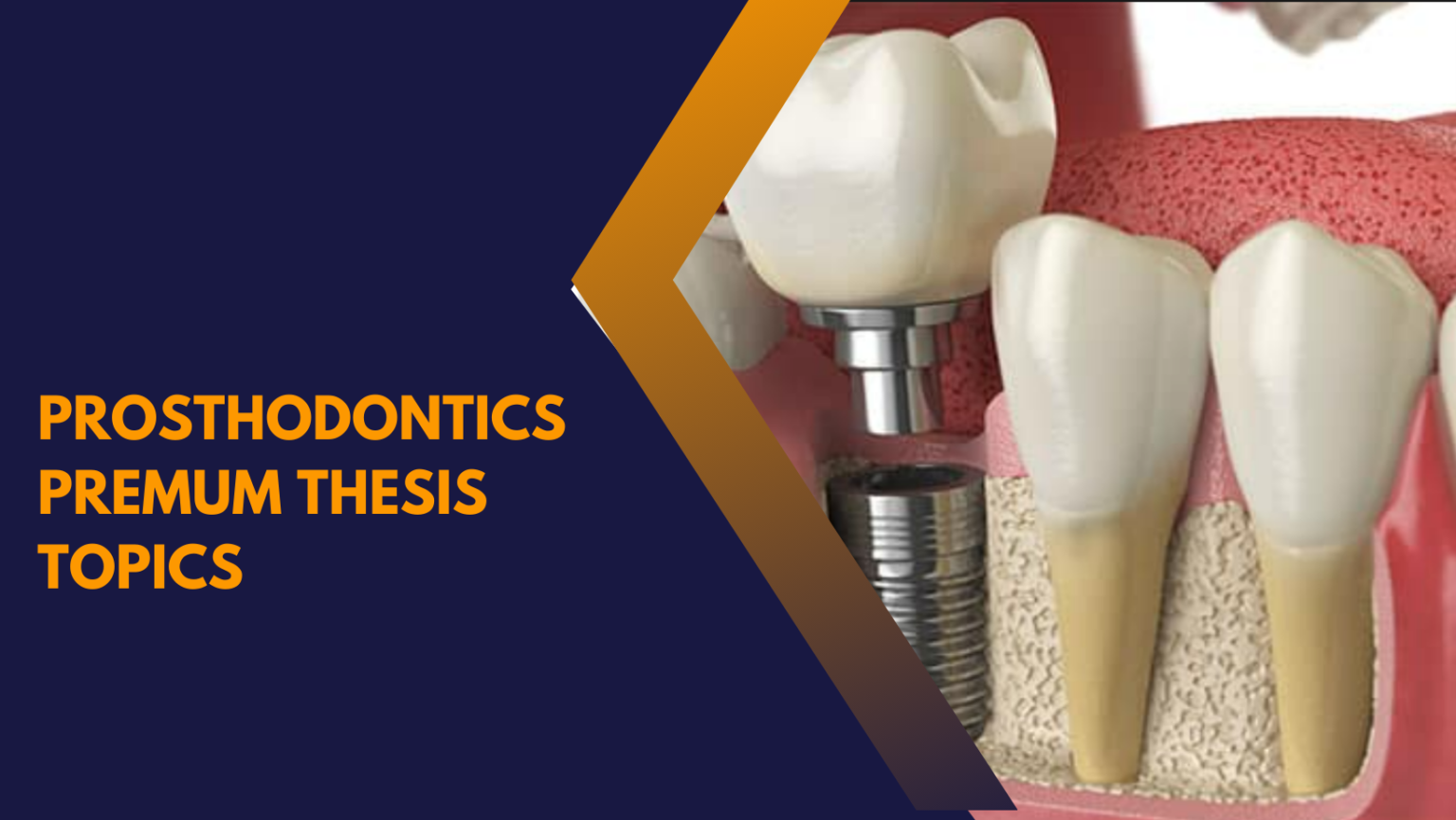 new research topics in prosthodontics