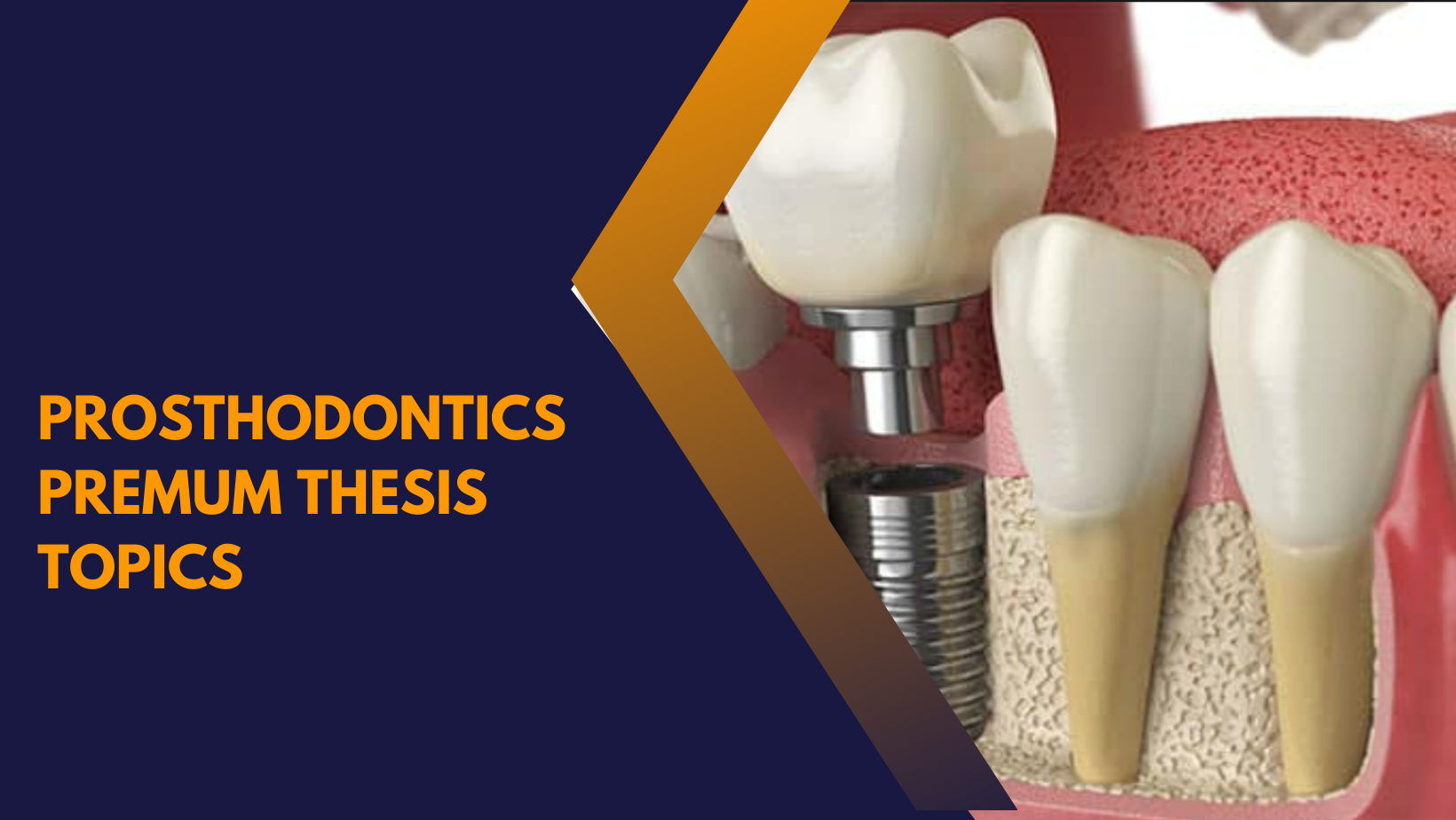 prosthodontics premium thesis topics