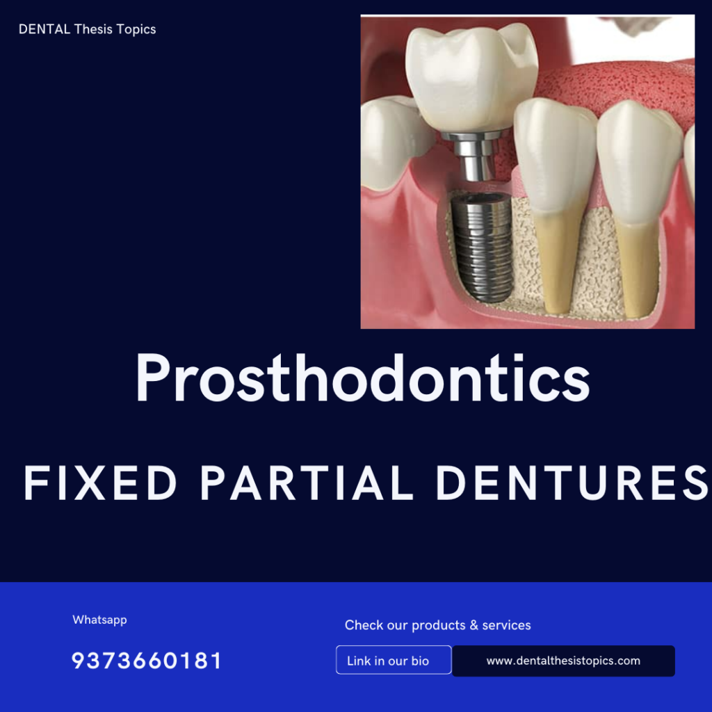 Fixed Partial Dentures