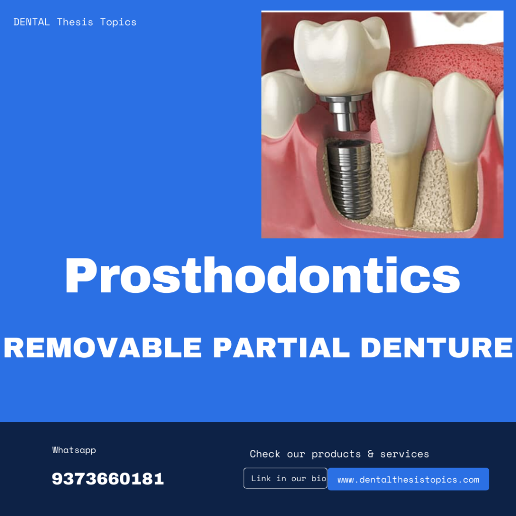 Removable Partial Dentures